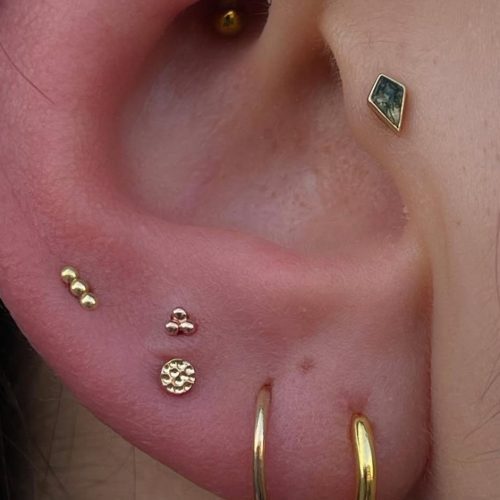 Ear curation consultation