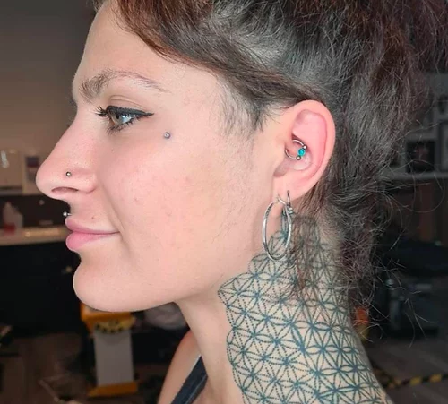 Dermal piercing removal