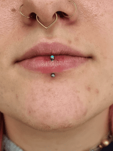 Veryical piercing performed by Jane at Eternal Gold in Glasgow with an implant grade titanium curved barbell