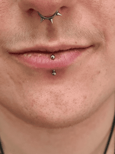 This is a vertical labret piercing done at Eternal Gold in Glasgow with implant grade titanium